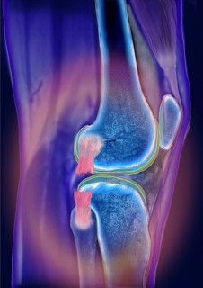 Knee joint