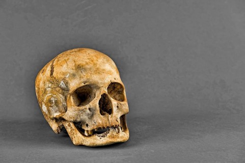 Human skull