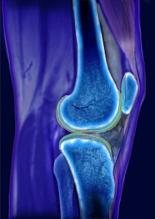 Knee joint