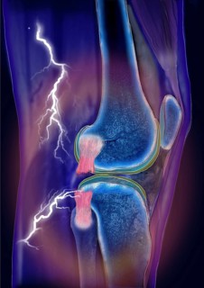 Knee joint