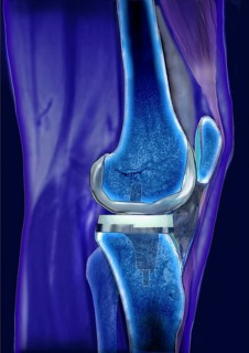 Knee joint