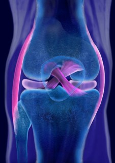 The cruciate ligament of a healthy knee