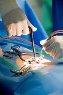 Hands of a neurosurgeon during spinal surgery in an operating room