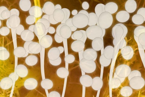 Yeast cells