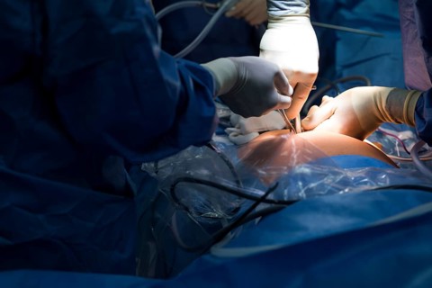 Abdominal surgery in a hospital