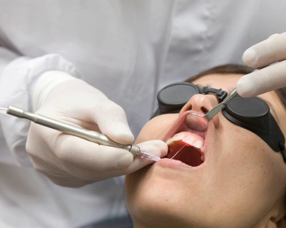 Dental treatment with laser
