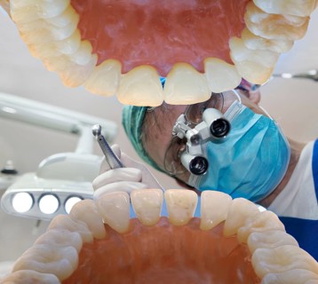 Dental treatment with drill