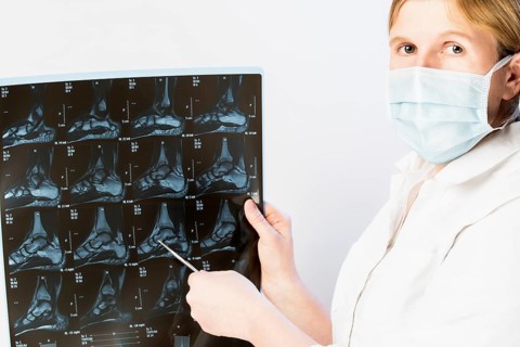 Doctor points to X-ray image