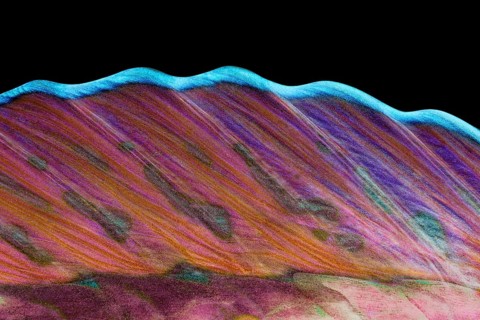 Dorsal fin