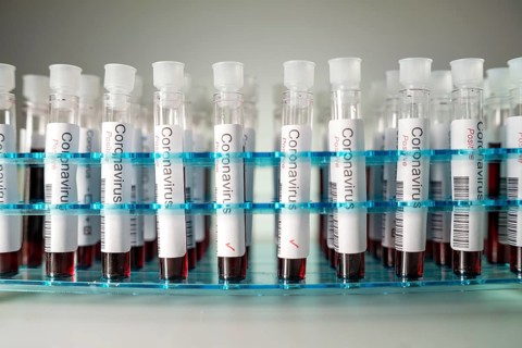 Positive results of corona virus tests