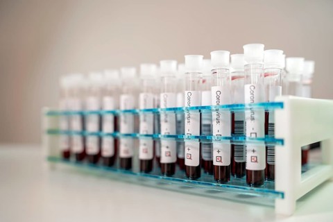 Positive results of corona virus tests