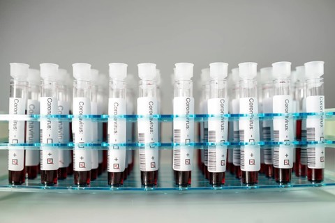 Positive results of corona virus tests