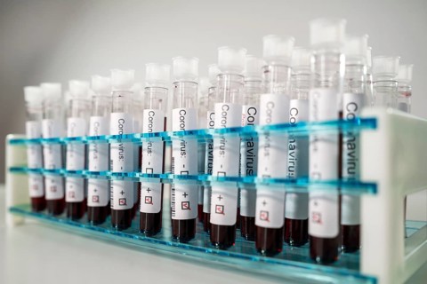 Positive results of corona virus tests