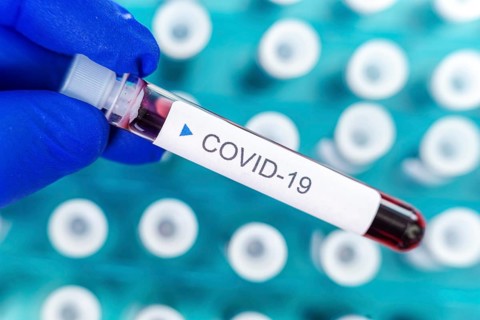 Hand holding blood test tube