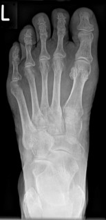 X-ray