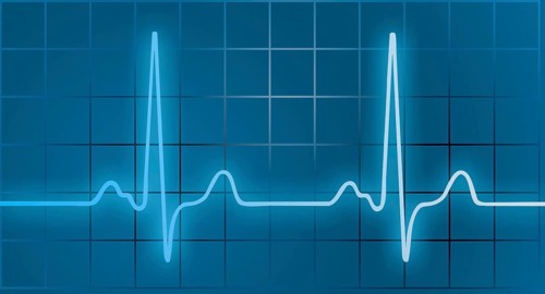 ECG