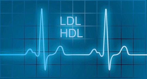 ECG