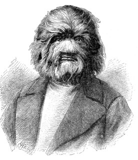 Dog-Faced Man
