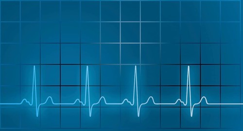 ECG