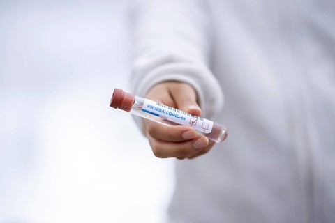 PEOPLE TAKING TEST OF CORONAVIRUS. taking blood samples