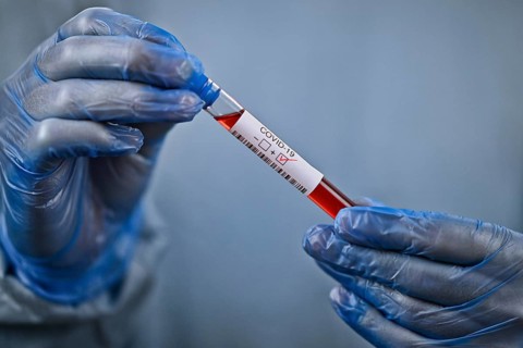 Holding hands with protective gloves Positive test result