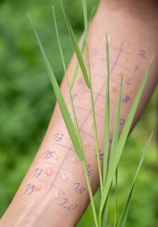 Allergy test