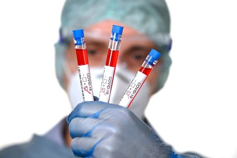 Positive test result