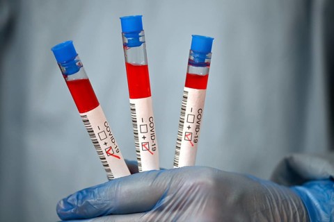 Positive test result