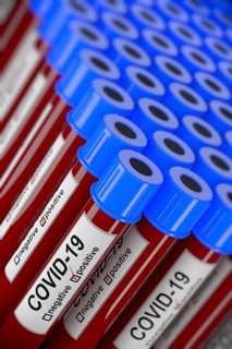 3D illustration of many blood test tubes with positive COVID-19 tests. Concept for laboratory sample of blood testing for diagnosis of the new Corona virus infection with selective focus