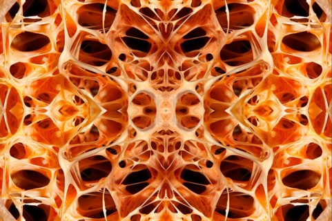 PHOTOMONTAGE