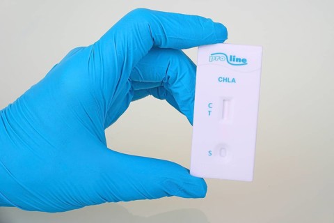 Quick test chlamydia of the company ProLine
