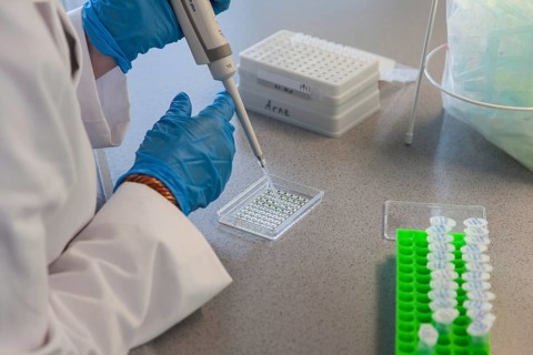 Student of the faculty of biology at the University of Duisburg-Essen during research work pipetting
