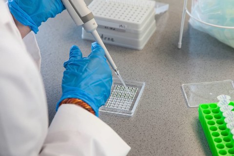 Student of the faculty of biology at the University of Duisburg-Essen during research work pipetting