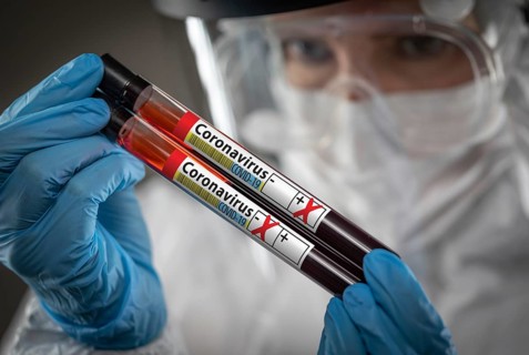 Female Lab Worker Holds Test Tubes of Blood Labeled Coronavirus COVID-19 Disease
