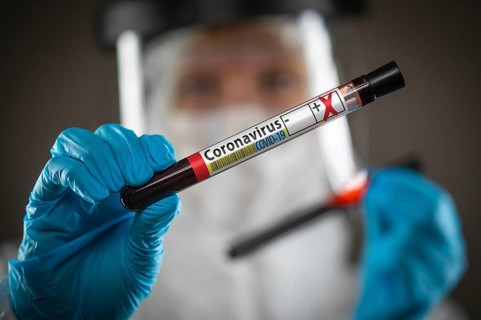 Female Doctor or Nurse Holding Test Tube of Blood Labeled Positive for Coronavirus COVID-19 Disease