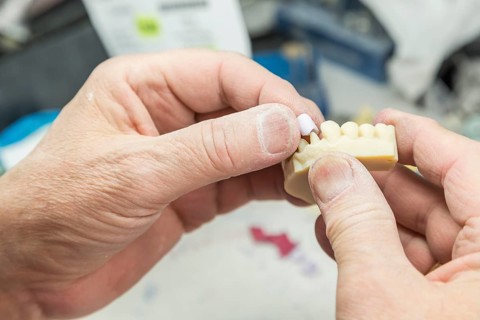 Male dental technician working on A 3D printed mold for tooth implants in the lab