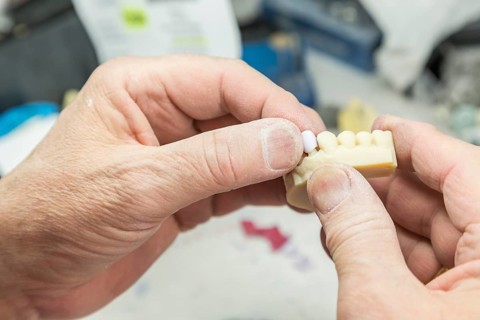 Male dental technician working on A 3D printed mold for tooth implants in the lab