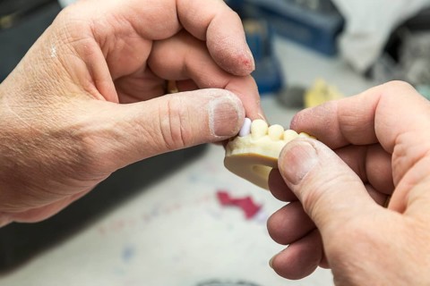 Male dental technician working on A 3D printed mold for tooth implants in the lab