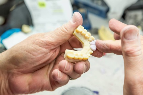 Male dental technician working on A 3D printed mold for tooth implants in the lab