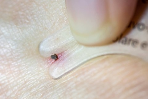 Castor Bean Tick (Ixodes ricinus)