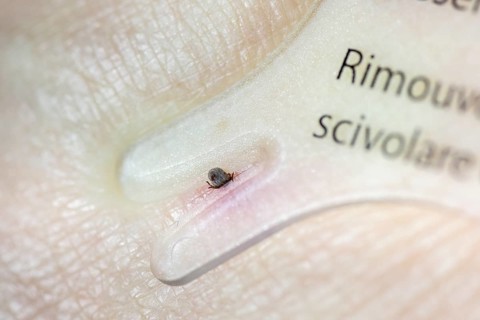 Castor Bean Tick (Ixodes ricinus)
