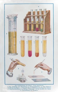 Urine examination