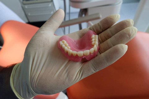 Full denture upper jaw made of plastic
