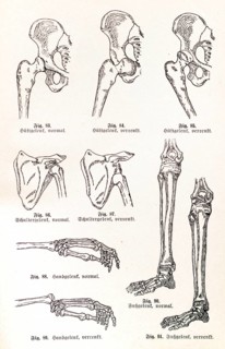 Dislocations (Lurations)