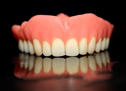 Full denture for the upper jaw made of plastic