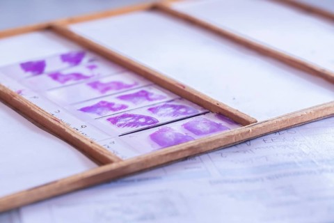 Histological preparations in the laboratory with protocol