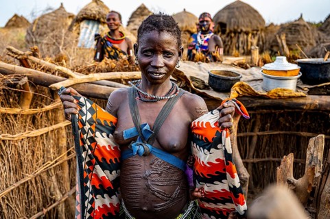 Woman with many beauty scars on her body