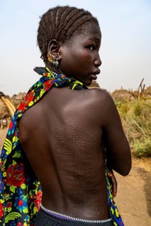 Scar face and body as a mark of beauty woman