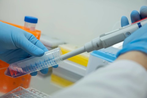 Medical laboratory assistant takes samples from a centrifuge tube with a pipette