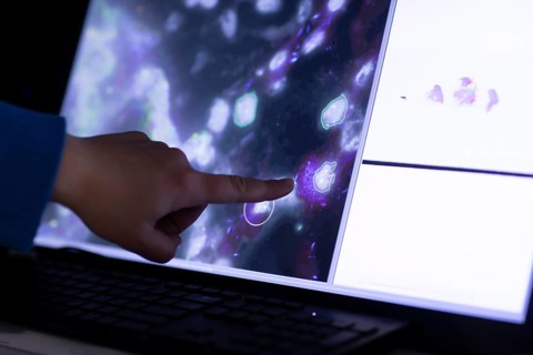 Sample evaluation on the monitor in a histology laboratory